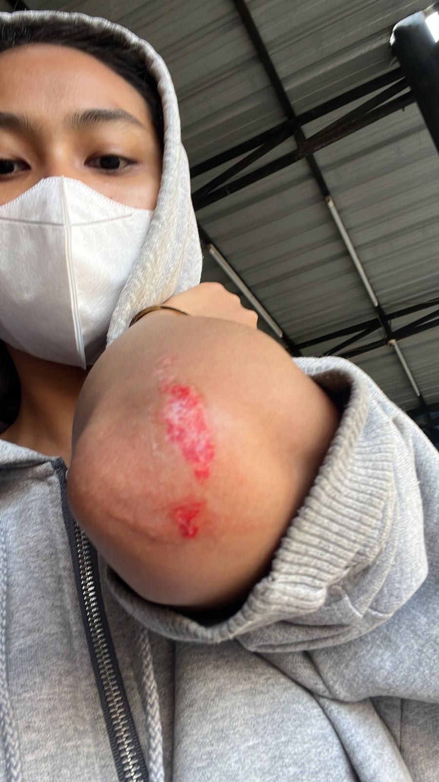 Thumbnail Aduan